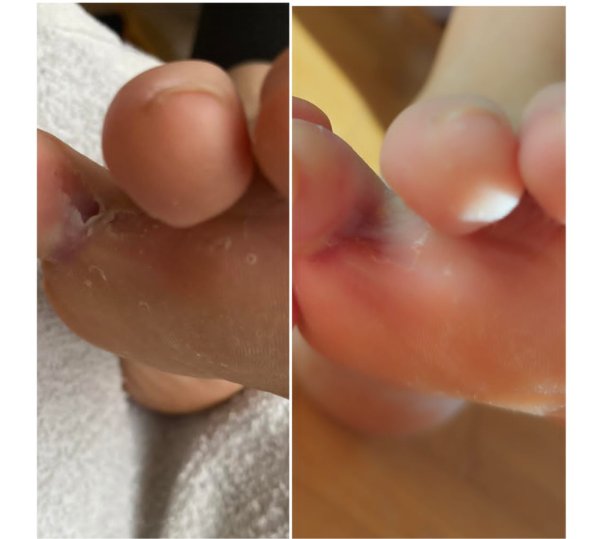 Mousse SOS Reparadora FeetCalm – Hongos y Pie de Atleta 🦶